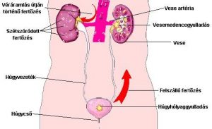 Heveny és krónikus húgyúti fertőzések kivizsgálása